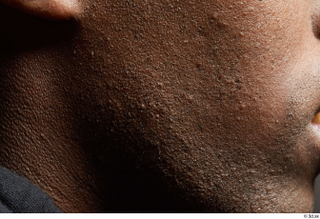 HD Face skin references Deqavious Reese cheek skin pores skin…
